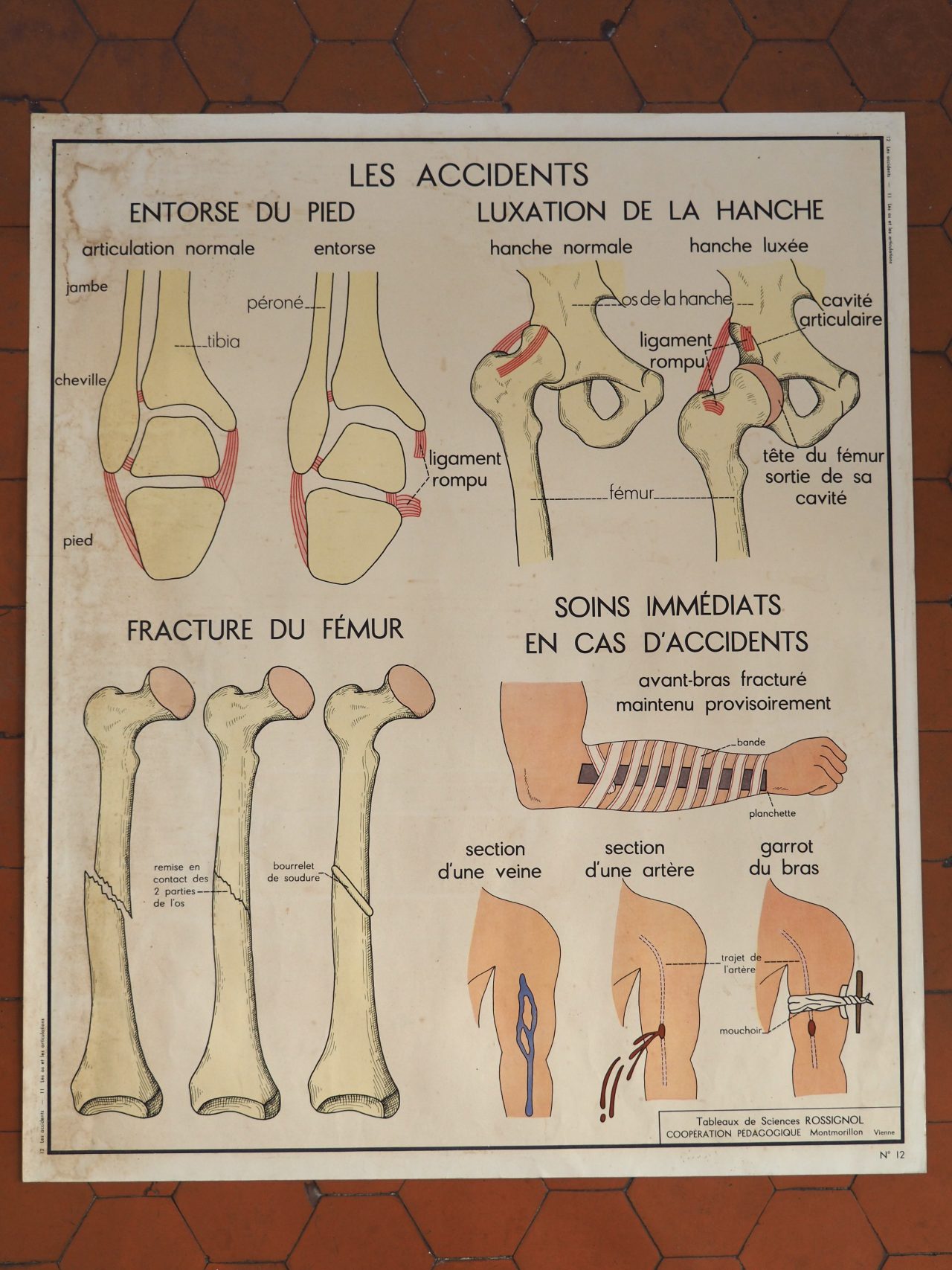 MaisonBoisDeRose affiche rossignol os articulations accidents5